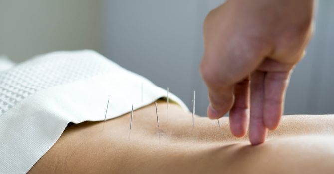 Benefits of Physiotherapy for Sports Injuries image