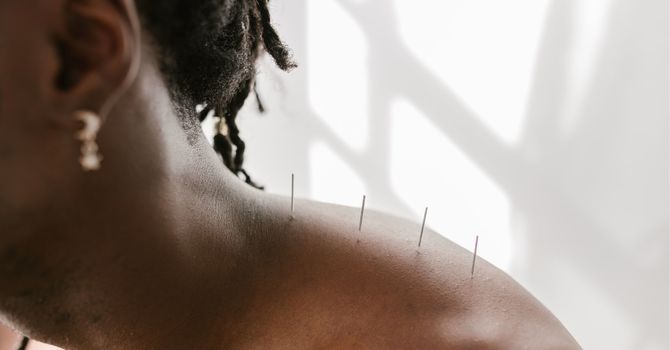 Benefits of Physiotherapy for Sports Injuries image